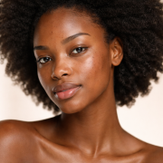Femme africaine avec hyperpigmentation et taches brunes sur le visage sans maquillage