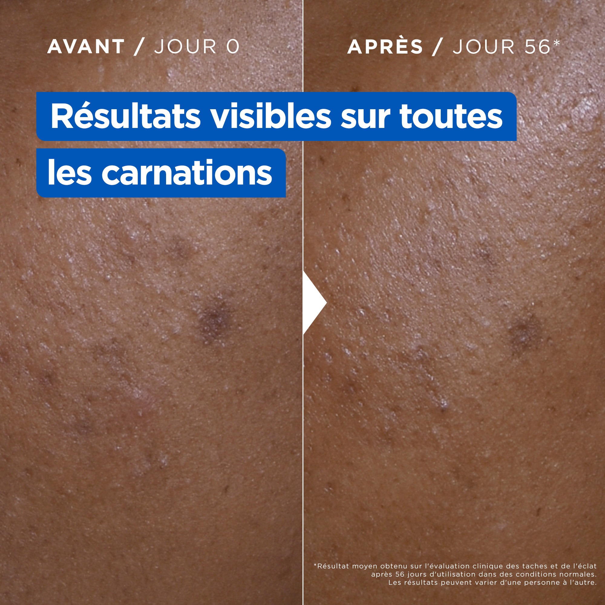 mixa_body-care_niacinamide_jar_pdp_fr03v2