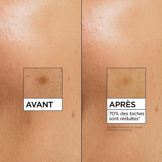 Sérum anti-tâche garnier vitamine C Lomé